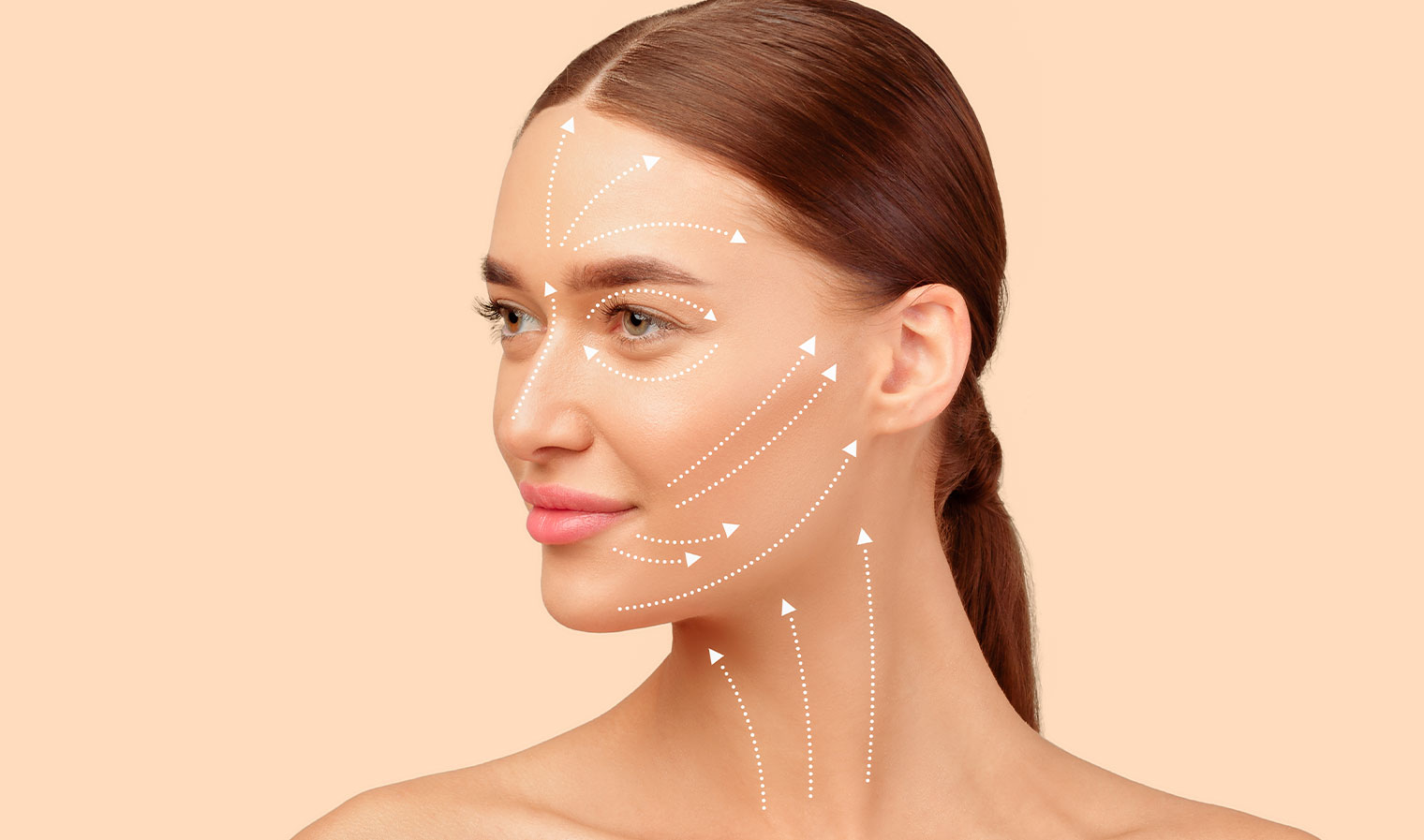 facelift